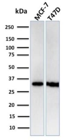 RPA2 Antibody (RPA2/3140R) - Azide and BSA Free, Novus Biologicals 100